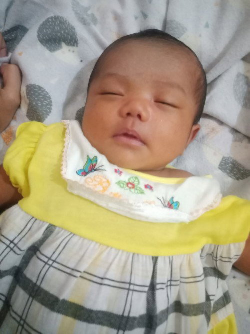 Kulit bayi