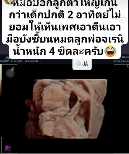 ท้อง5เดือนหมอบอกน้องตัวใหญ่กว่าเด็กปกติ 2 สัปดาห์ แบบนี้ปกติไหมคะ ไม่เห็นหมอพูดอะไร ก้แอบกังวลนิดนึง