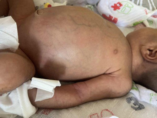 Perut bayi jadi besar