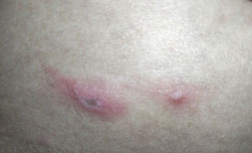 tiba tiba muncul diperut