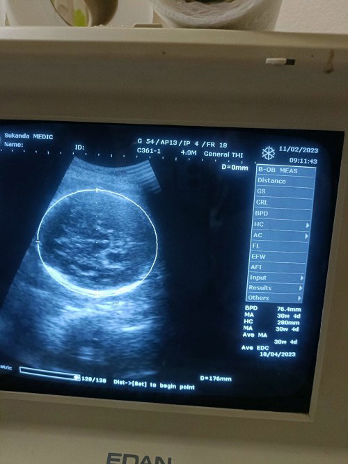 ไปซาวน้องมา30+5