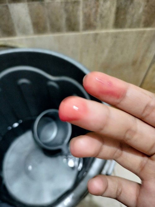 Keluar darah di vagina saat bab