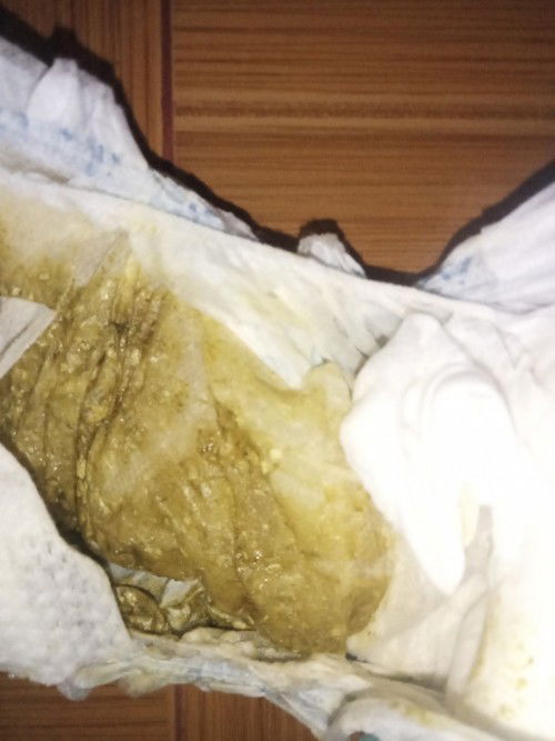 ask ko lng po,normal lang po ba ito,7month old baby ko po,