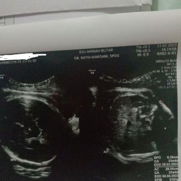 Bb janin masih kurang banget
