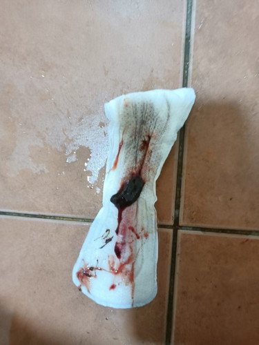 saya pregnant 5 minggu 3 hari
