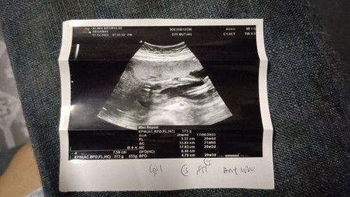 Hye ibu2 nk tye betul ke jantina bby saya ni..bby girl..sbb doc kk n swasta pon ckp yg sama.bby girl