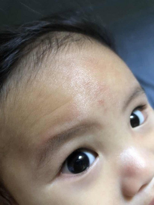 BABY DRY FACE