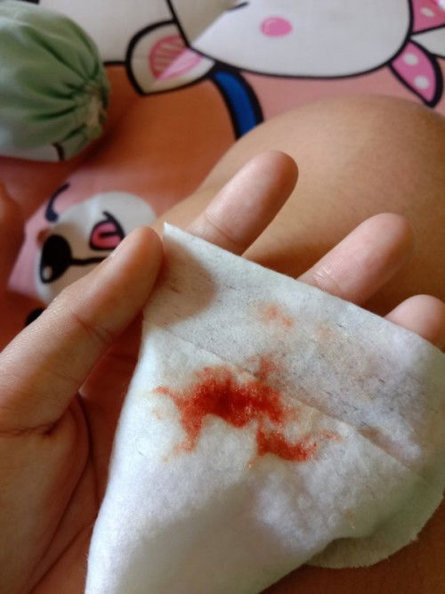 เป็นไปได้ไหมคะคลอดลูกได้1เดือนแล้วน้ำคาวปลายังไม่หมดแต่มีประจำเดือน