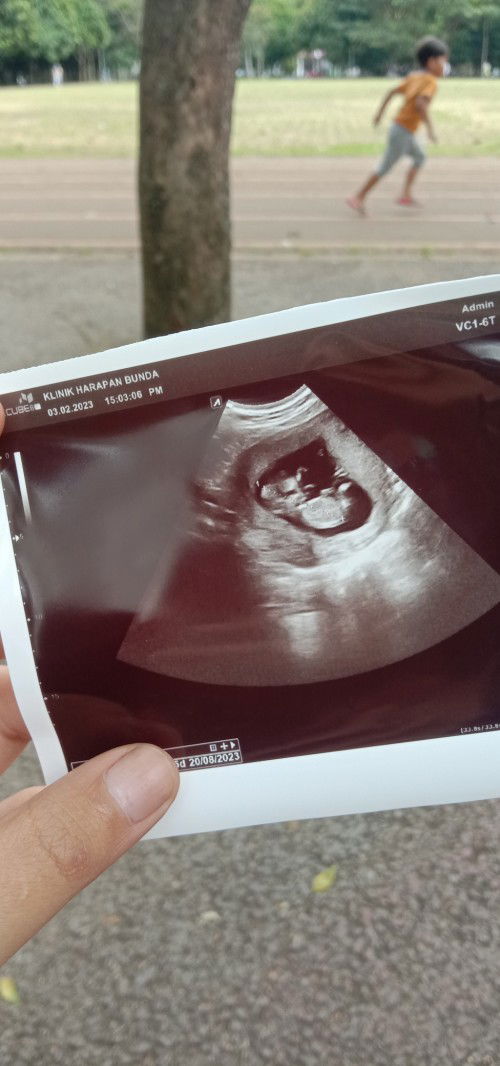 Bun, ini waktu USG usia 12week, sy kaget baby nya udh sebesar ini? Ini normal tdk? Tp perut sy kecil