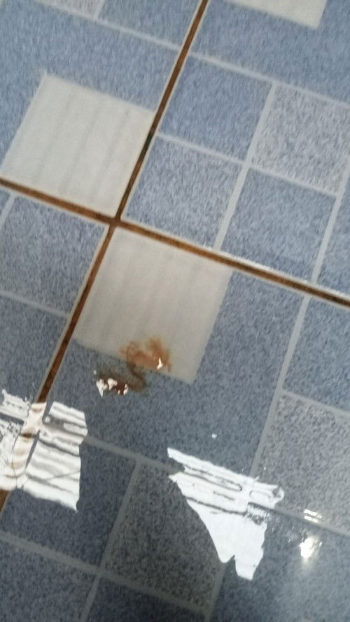 Flek saat hamil mau 5 bulan