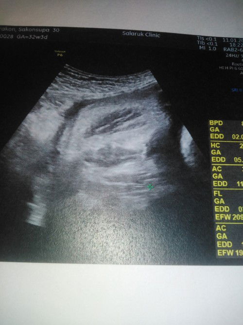 แบบนี้​ ช/ญ​ คะ