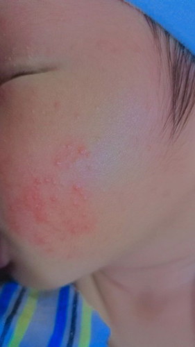 hello po, ano po kaya pwedi igamot sa rashes ni baby, Ftm po ako
Pa help naman po .