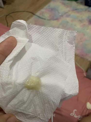 อายุครรภ์37+6w มีมูกใสๆ