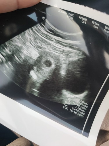 6วีค ยังไม่เจอตัวน้องมีใครเป็นเเบบเราบ้างคะ