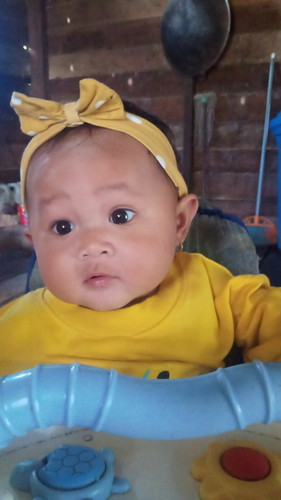 Bayi umur 7 bln blm bisa merangka sama duduk sendiri,bisanya tengkurap sambil mundur bukn manju