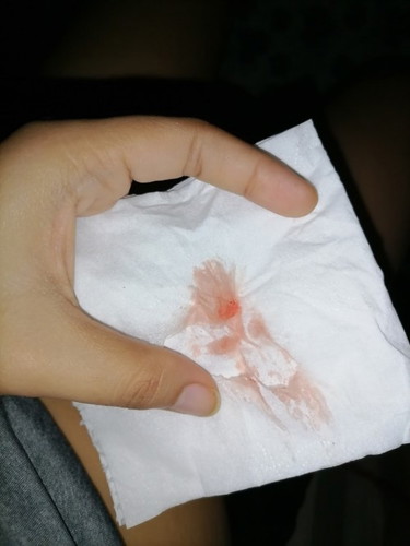 Implantation Bleeding