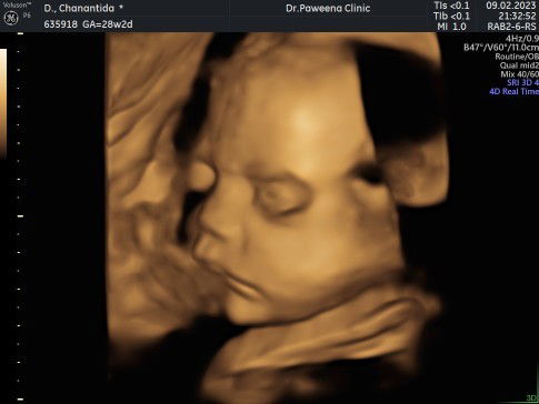 อัลตราซาวด์แบบ 4 มิติ แม่ๆๆบ้านไหนไปซาวด์มาบ้างไหมค่ะ เห็นลูกไฟชัดไหมค่ะ