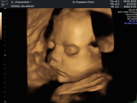 อัลตราซาวด์แบบ 4 มิติ แม่ๆๆบ้านไหนไปซาวด์มาบ้างไหมค่ะ เห็นลูกไฟชัดไหมค่ะ