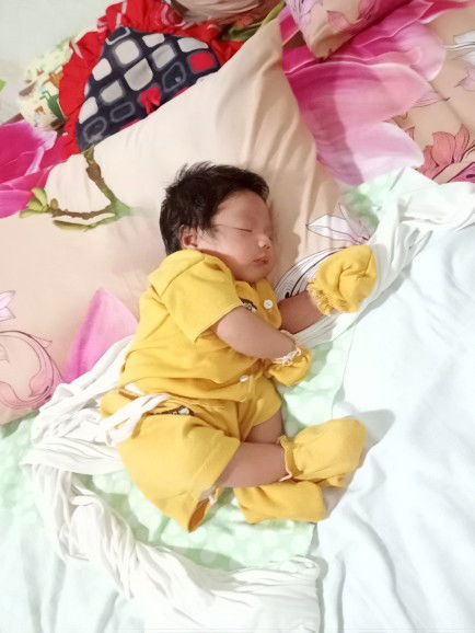 baby 29 hari sering ngejan"