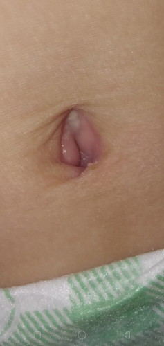 Hello mga momies 4months npo baby ko bkt po prng sariwa padin ung pusod nya Anu poba dpt Kong gwin