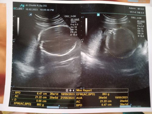 BB janin dan posisi janin