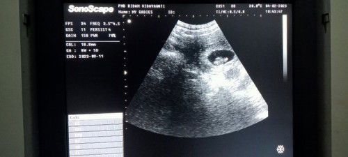 Hasil USG berbeda dgn HPHT