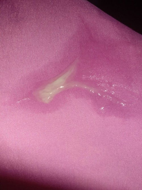 ท้อง38สัปดาห์5วัน มีอาการมวลท้อง