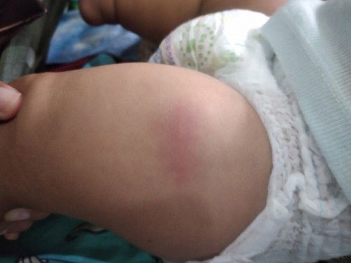 Minta sarannya dong bund