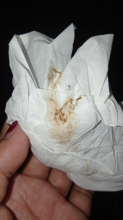 Sumbatan lendir keluar