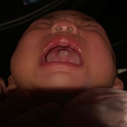 แพดานปากแปลกๆ