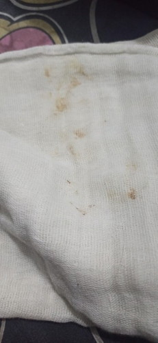 Anu po kaya yung brown sa lungad ni baby? 3months plng po sya normal lang po ba yun