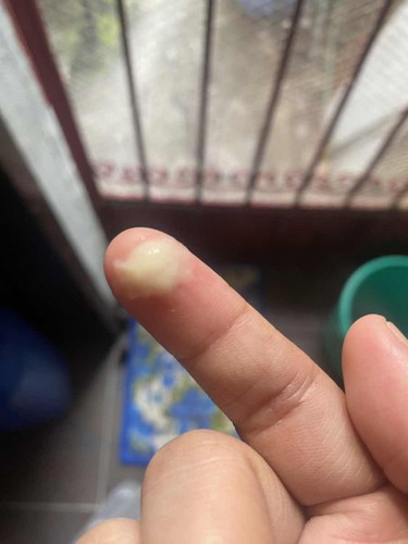 Mucus plug ba ito?