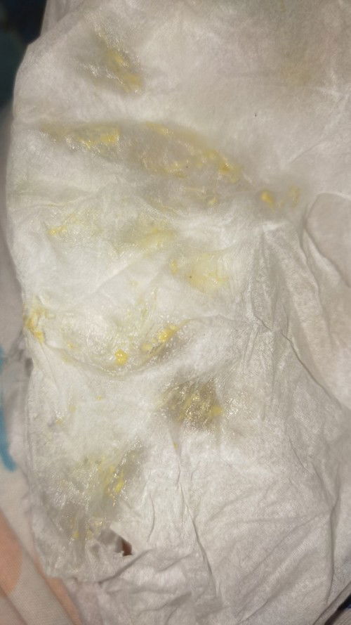 Sakit payudara setelah mengasihi, apakah mastitis?