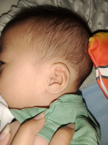 ลูกหูบี้ทำไงดี