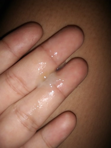 มีแบบนี้ควรไปหาหมอมั้ยคะ