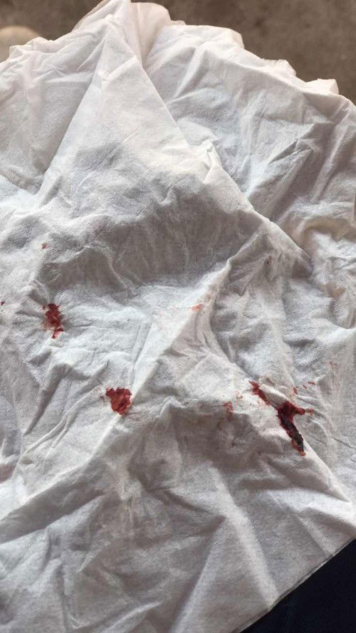 เพราะโฮโมนหรอคะ