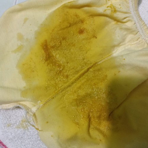 Các mom cho mình hỏi bé nhà mình đi ngoài như vậy có phải là bị tiêu chảy ko ạ