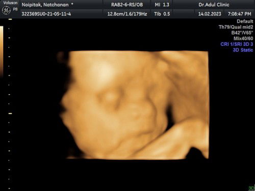 แชร์ความน่ารัก 4D 27w6d 💖👶🏻