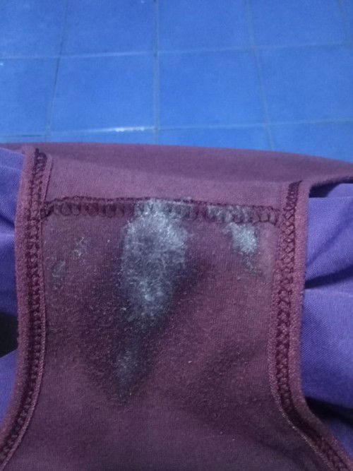 ใกล้คลอดแล้วเเม่เป็นเหมือนกันมั้ยค่ะ