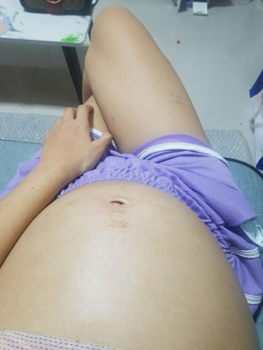19วีคท้อง2ท้องใหญ่มาก