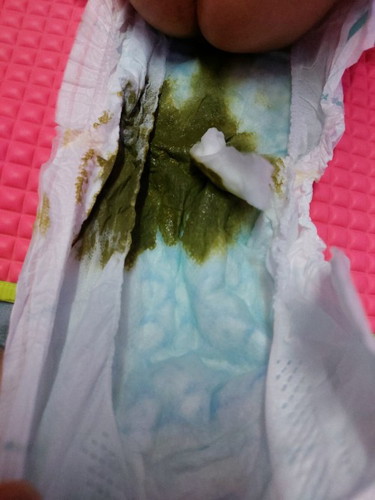 Color Green Poop
