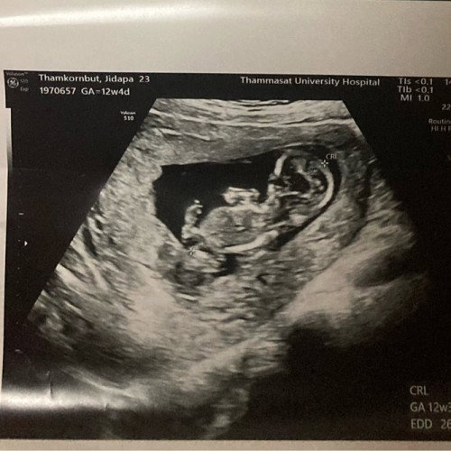 เจ้าก้อน12 week 4d