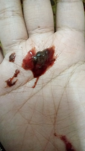 Fist bby gugur ke????