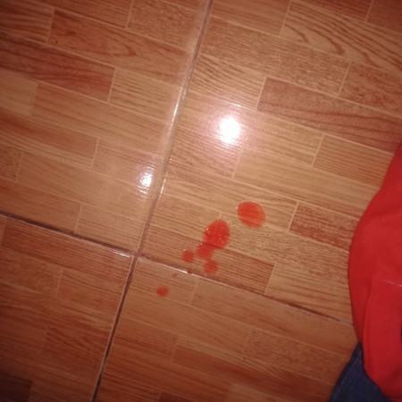 มีเลือดออกแบบนี้อันตรายไหมค่ะ