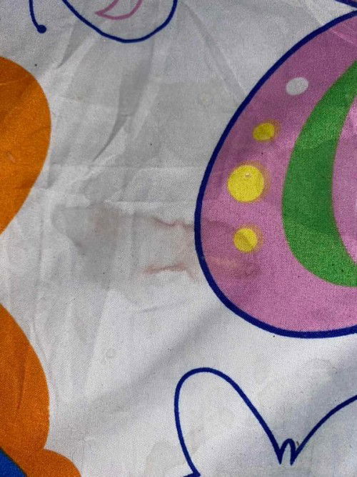 Ini flek atau bukan ya bun?