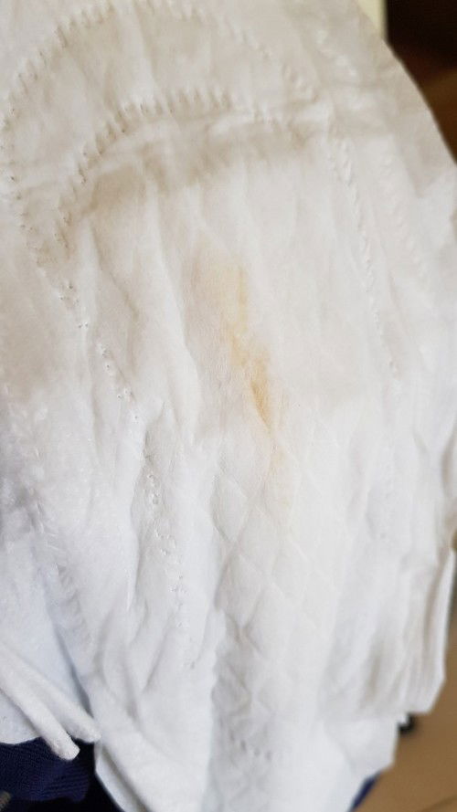 Flek awal kehamilan atau bukan y bun??