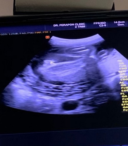 รบกวนหน่อยค่ะ😂