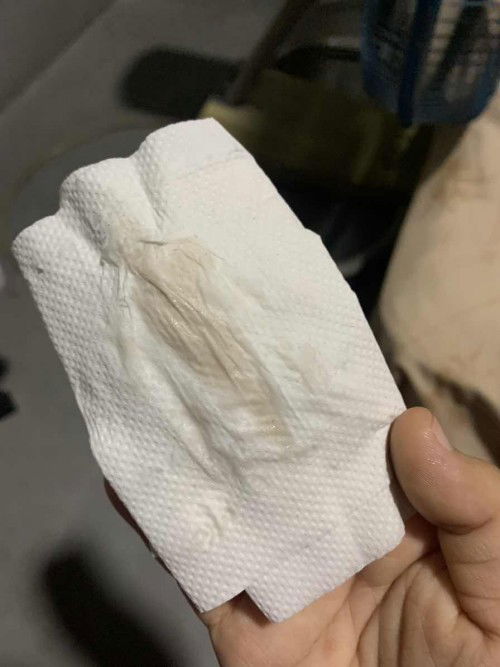 มีมูกเลือดออกมาตอนฉี่แบบนี้ต้องไปหาหมอเลยไหมคะ แต่มีอาการปวดท้องร่วมด้วยแต่ไม่ได้ปวดมาก 38+2