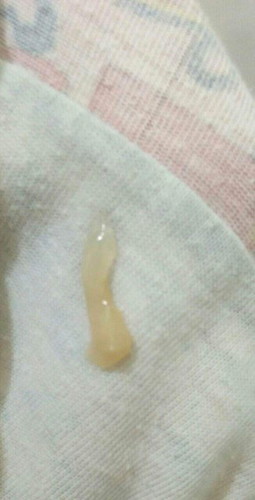 Mucus plug n kaya to?