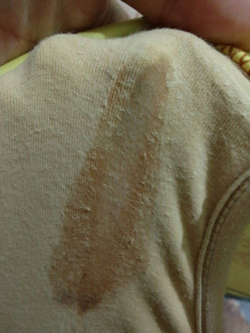 Ptp po. Excuse lang po sa mga kumakain. Maselan ang nasa larawan.